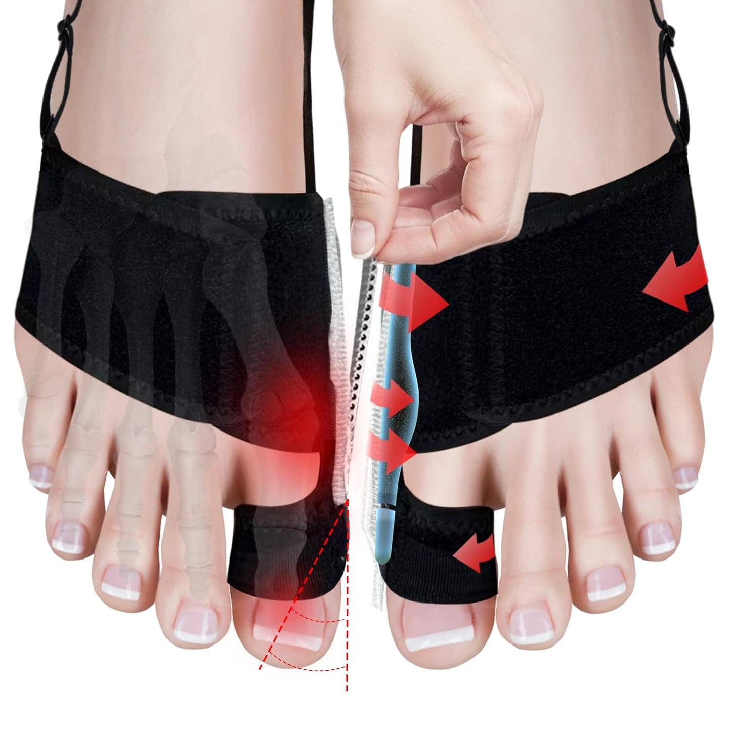 🦶 Neoprene Bunion Toe Corrector - Premium Quality🏆