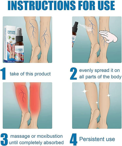 Varicose Veins Treatment